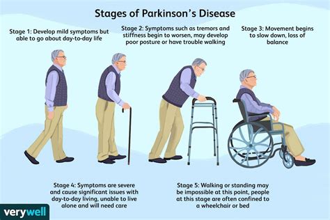 progress of parkinson's disease